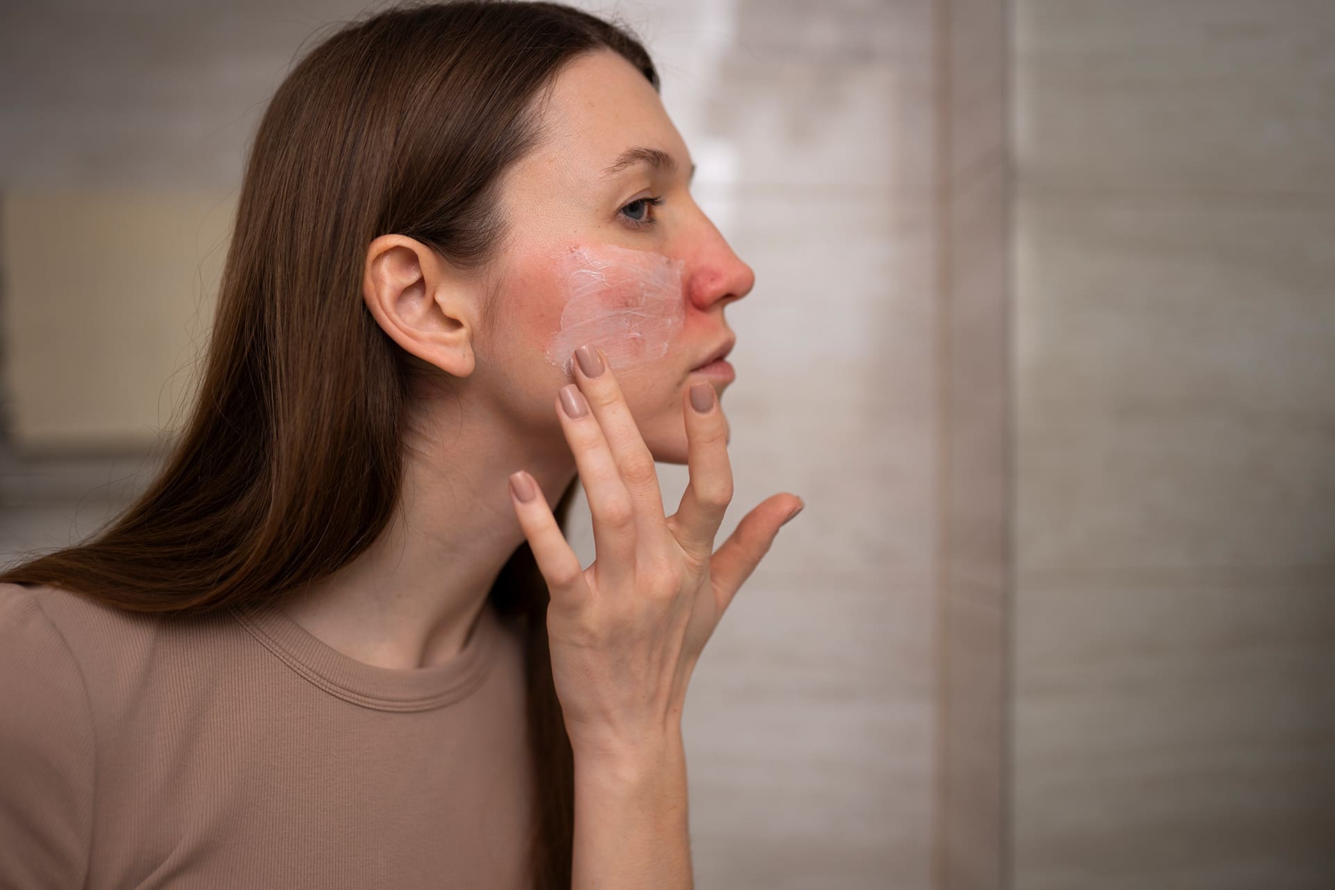 skin conditions